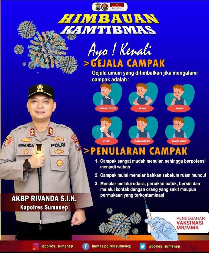 Kasus Campak di Sampang Meningkat, 193 Pasien Positif